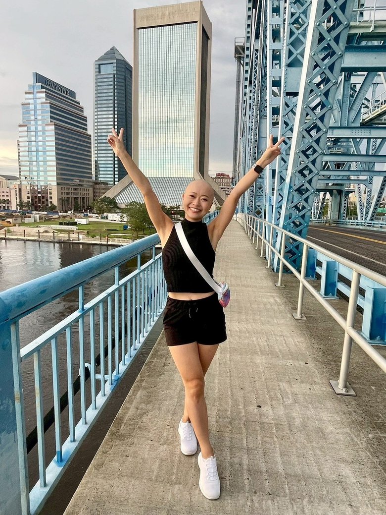 乳がんを患い、定期的な検診の大切さを改めて実感。「早期発見がすごく大事」と呼びかける