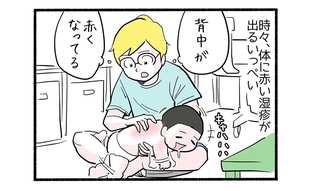 育児は病気との攻防戦３「たまごアレルギー発覚」