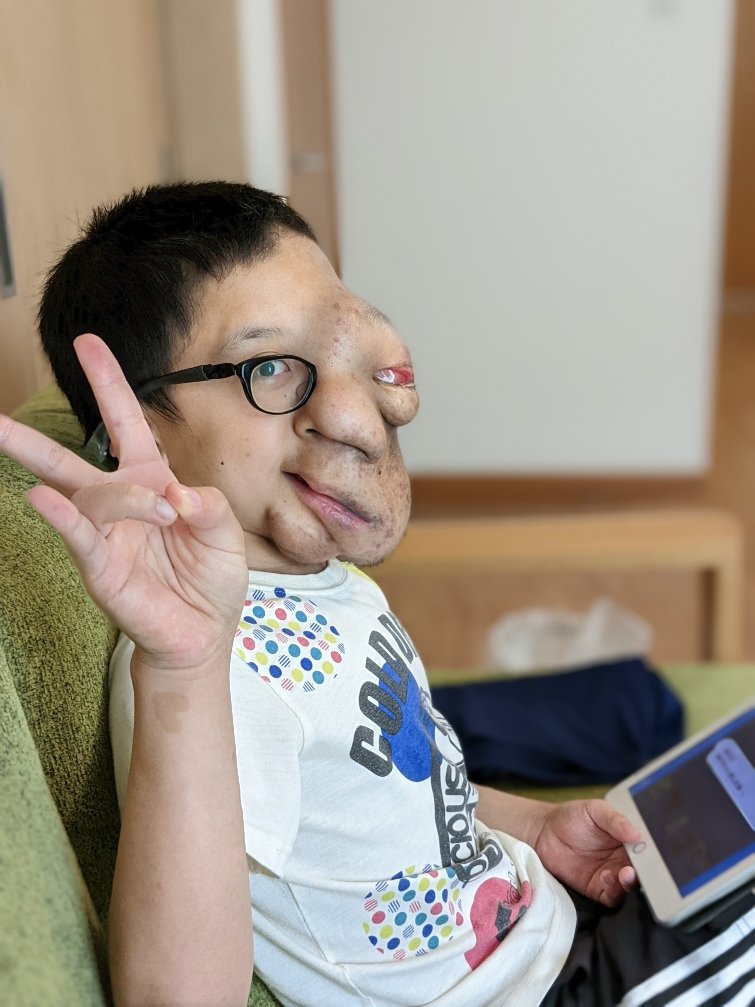 小学6年生、みずから病気について語るYouTubeを編集中