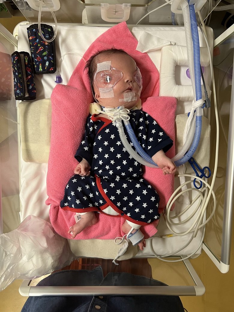 生後1か月。目の保護方法を模索中