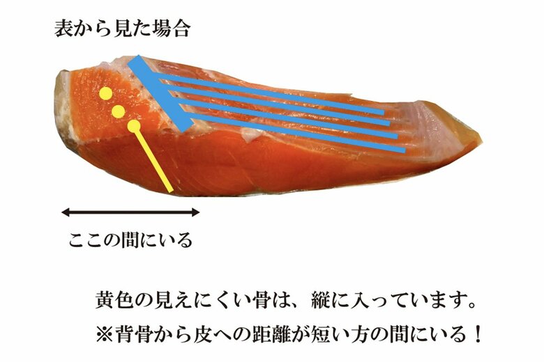 表から見た場合の「弓型」の骨の位置。青と黄色のラインが骨。