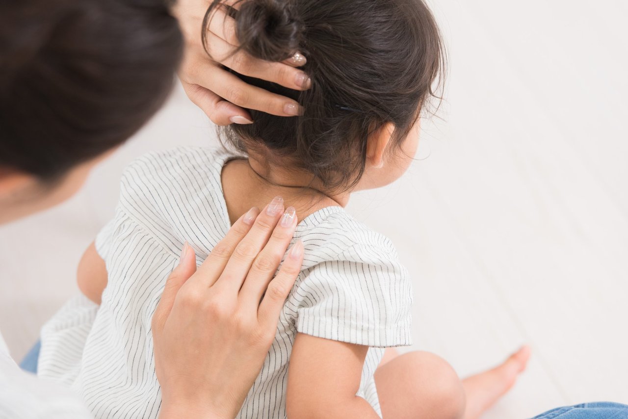 アレルギー反応でかゆがる子ども