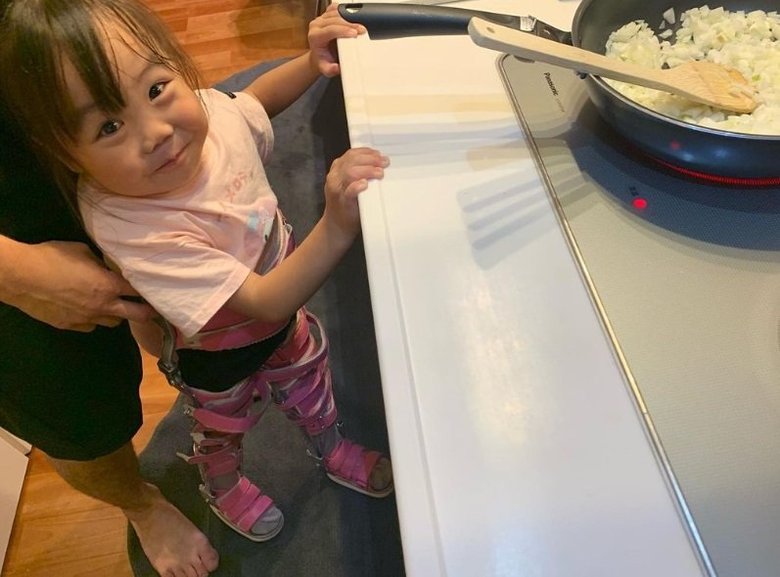 1年前のりおなちゃん。足に装具をつけながらもニッコリ笑顔