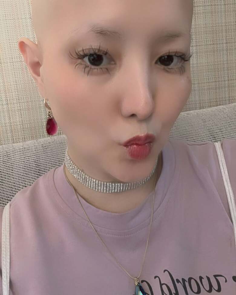 髪が抜けてもオシャレを楽しんでいるという希良梨さん