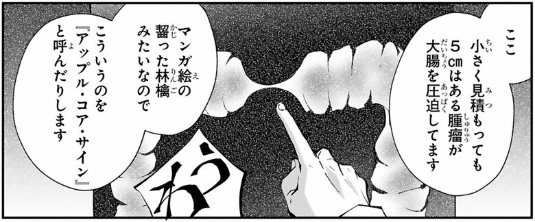 漫画『末期ガンでも元気です　38歳エロ漫画家、大腸ガンになる』第2話（42/54P）