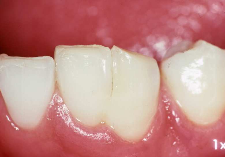 引用：口腔病理基本画像アトラス