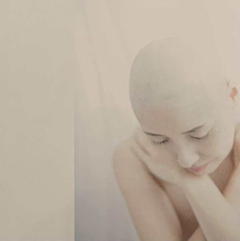 抜毛症公表後、初めてのプロによる撮影写真