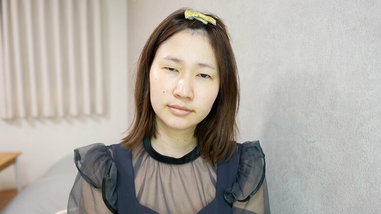 小学生のとき、男子に「おまえの目、もやしみたいだな」と言われたそう