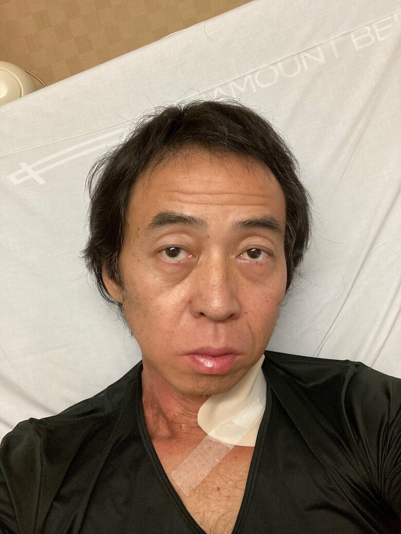 副作用がしんどかった2か月の入院期間。ワッキーさんから笑顔が消えた