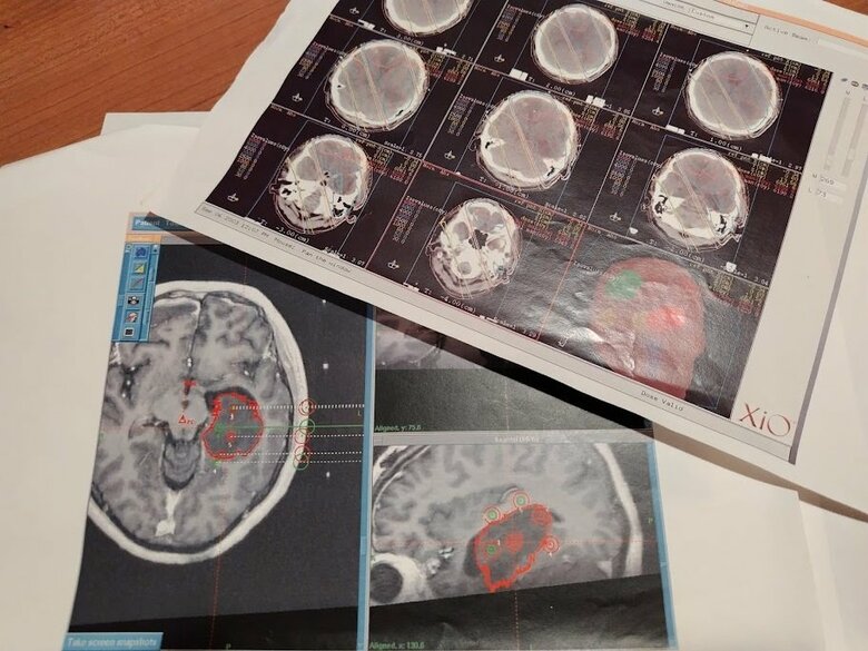 何十回も受けたMRIの画像
