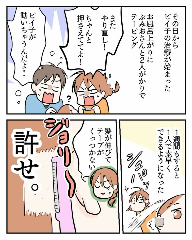 漫画「埋没耳治療しました」7