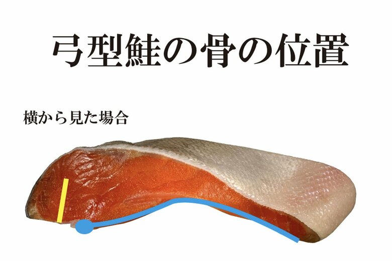 横から見た場合の「弓型」の骨の位置。青と黄色のラインが骨。