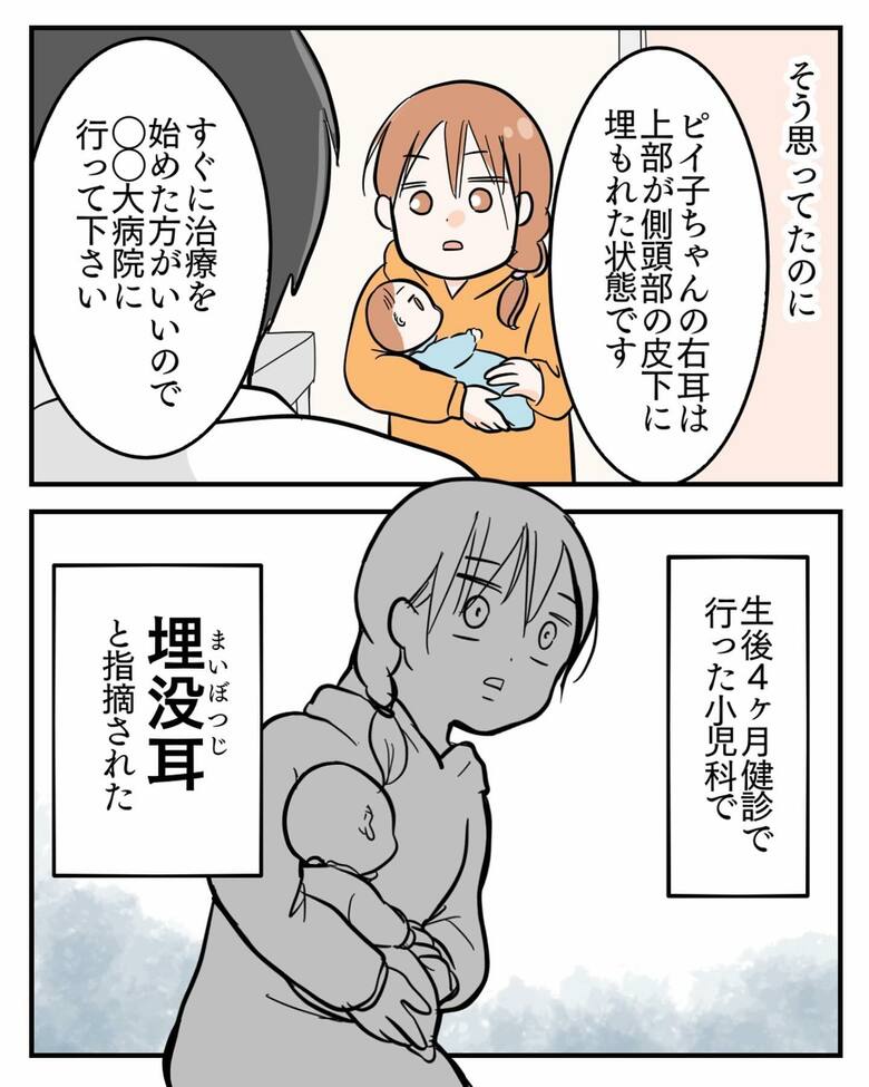 漫画「埋没耳治療しました」4