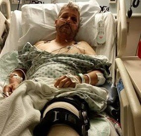 さまざまな理由からお金の無心が続いた。マーク・ラファロをかたる偽者（AI技術を用いた合成写真）から送られてきた「ケガをした証拠写真」