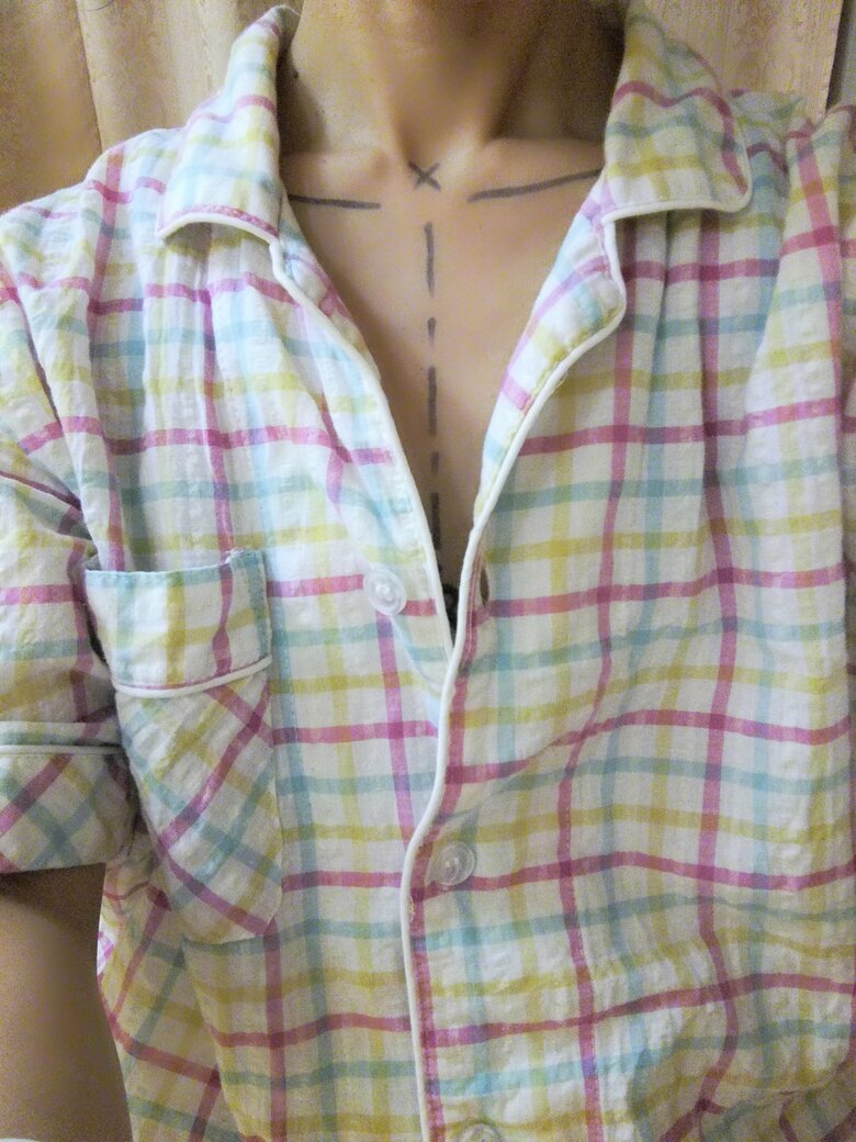 乳房再建手術前の様子