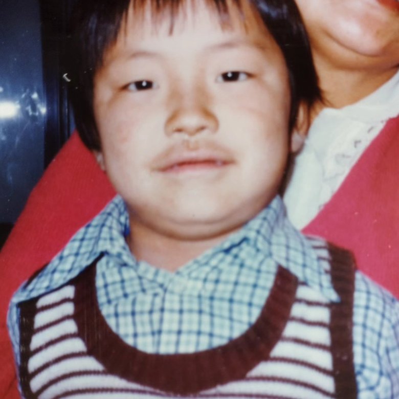 幼少期の大城さん。塩水がしみるため海水浴もできないくらいアトピーの症状がひどかったそう