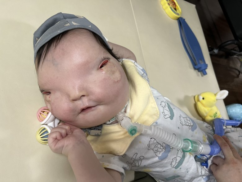 1歳4か月。よく笑うようになった