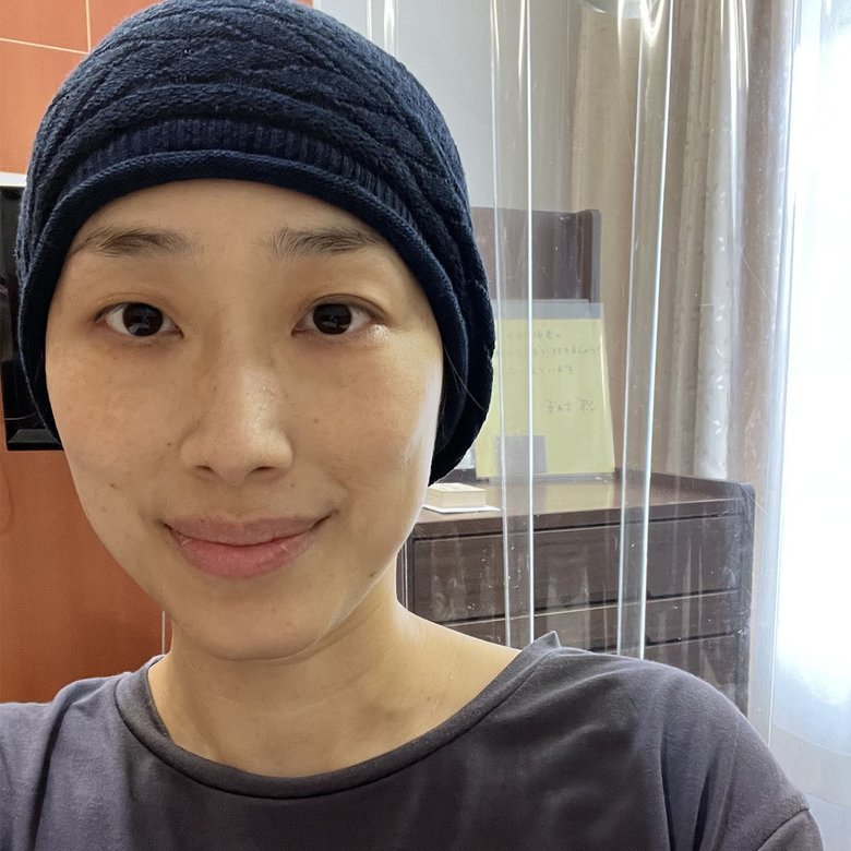 寛解導入療法開始後、3週間目の様子。髪はごっそり抜け、帽子を着用