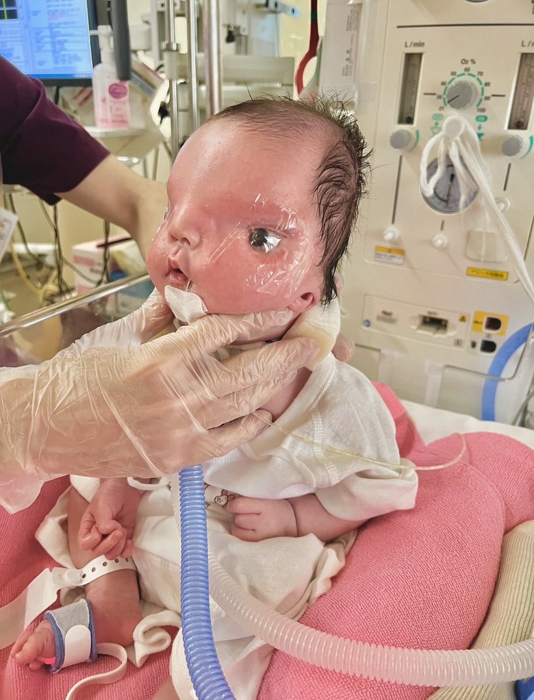 生後1か月。リハビリの様子