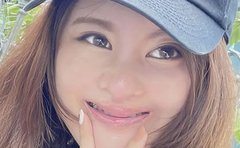 《口唇口蓋裂で21回の手術》中学で孤立し不登校だった女性「自分を肯定してくれるギャル友の言葉」が人生の転機に