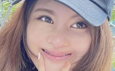 《口唇口蓋裂で21回の手術》中学で孤立し不登校だった女性「自分を肯定してくれるギャル友の言葉」が人生の転機に