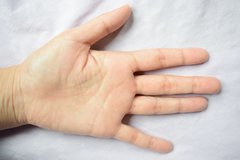 《熱中症予防》手のひらを冷やすのが有効？最近の研究で明らかに「冷えたペットボトルで深部体温を効率的に下げる」