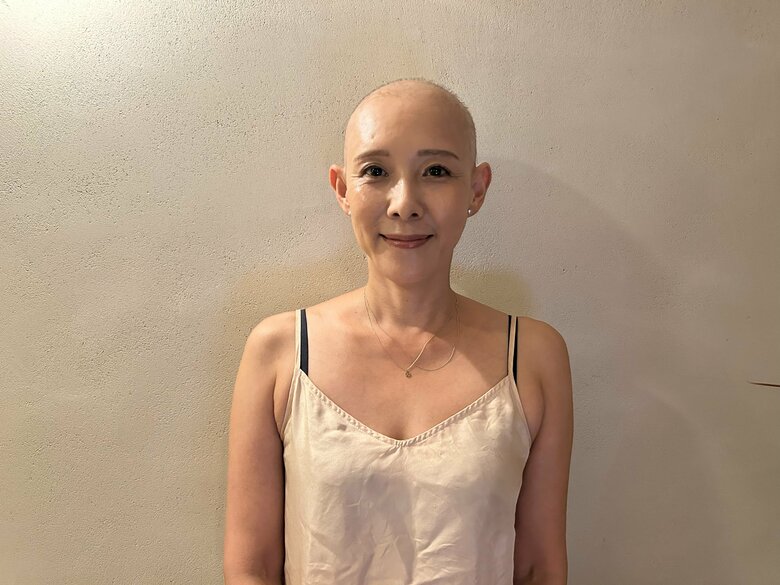 抗がん剤治療で髪が抜けても、明るく公表した