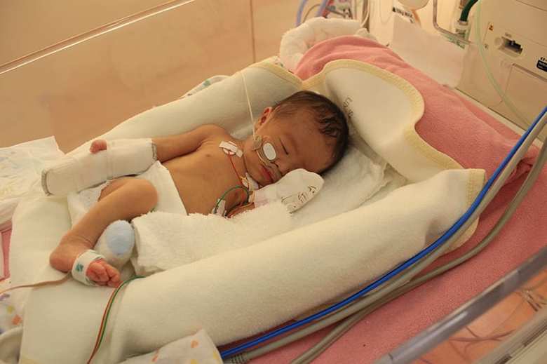 生後3日目に絵里さんが撮影した愛子ちゃんの写真