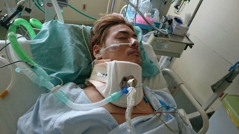 自転車事故直後から、自身の姿を積極的に公開してきた