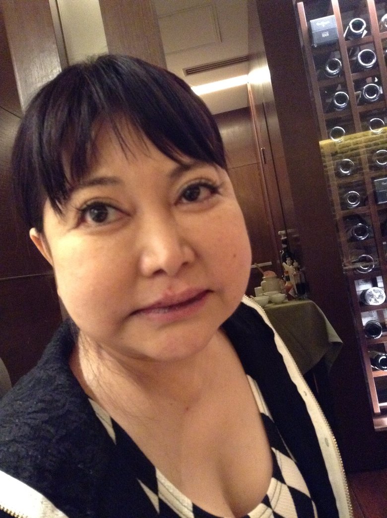 治療で服用したステロイドの副作用で、ムーンフェイス（顔が腫れる）に