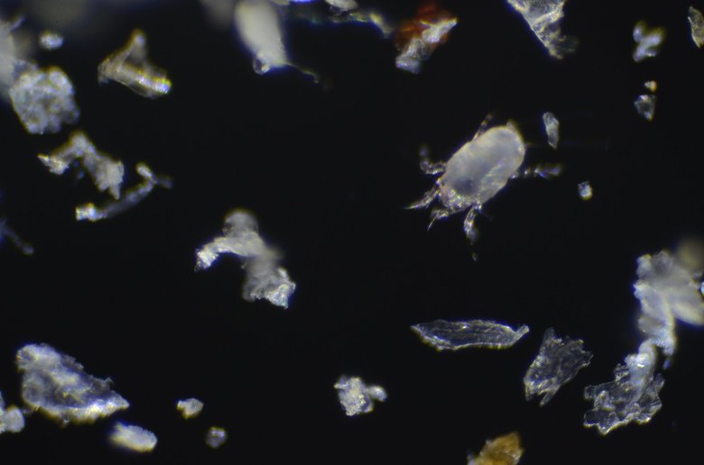 【ダニの体長】0.1mm～0.3mm程度と非常に小さく肉眼では見えない