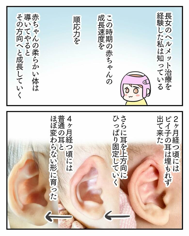 漫画「埋没耳治療しました」8