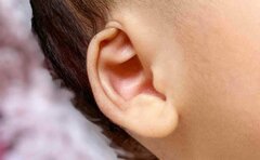 「いびつな耳の形も個性」と楽観視していたら娘が生後4か月で「埋没耳」と診断された話「気になったら早めの受診を」