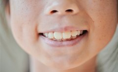 「ろうそくが吹き消せないのは歯のせい？」虫歯がなくても要注意！いま子どもの口に起きている「深刻な問題」
