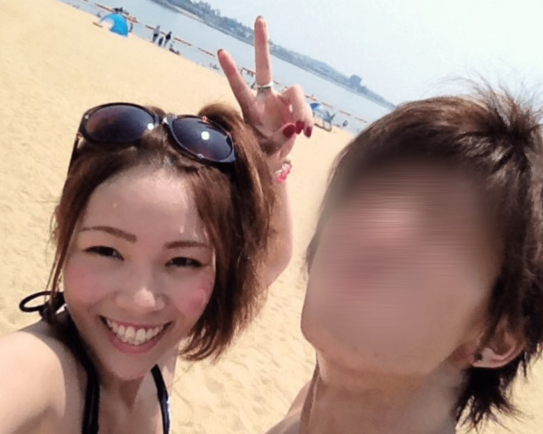 ストーマ造設前はお尻に管が入っていた