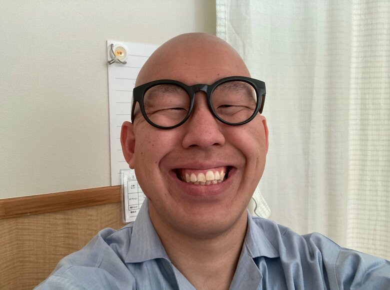 抗がん剤の影響ですっかり髪が抜け落ちツルツルに