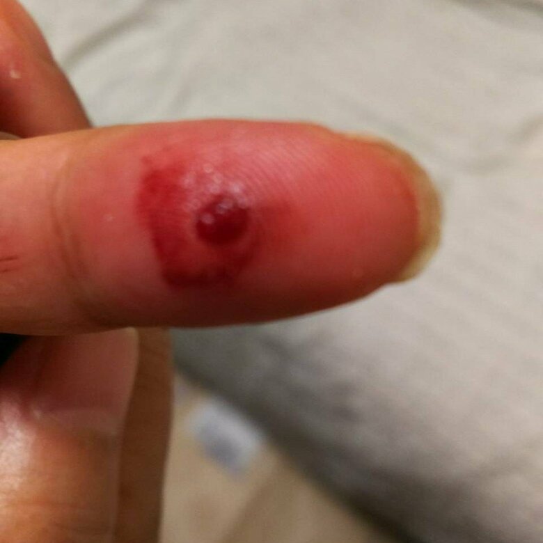 互いに指先を傷つけて血を重ね合う「血の誓い」をモニター越しに行った