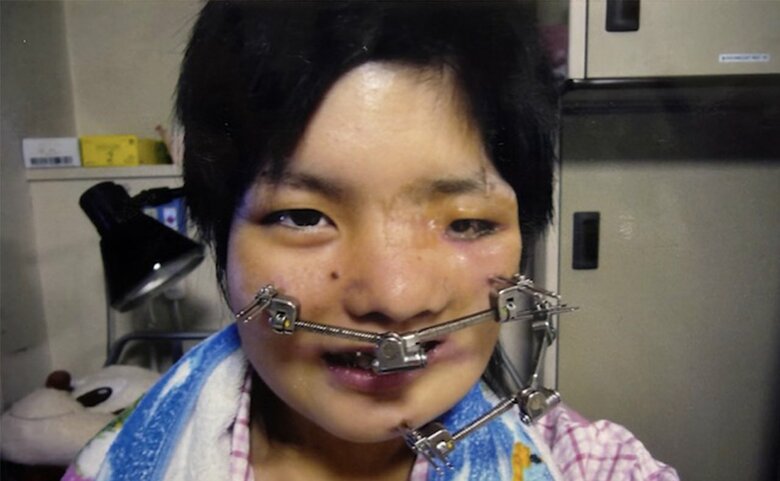 初めての手術で入院したとき