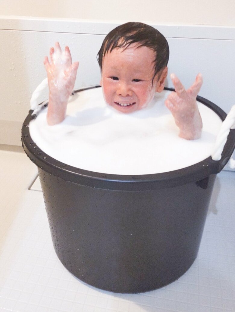 皮膚がはがれ落ちるので、何度もお風呂に入ることも