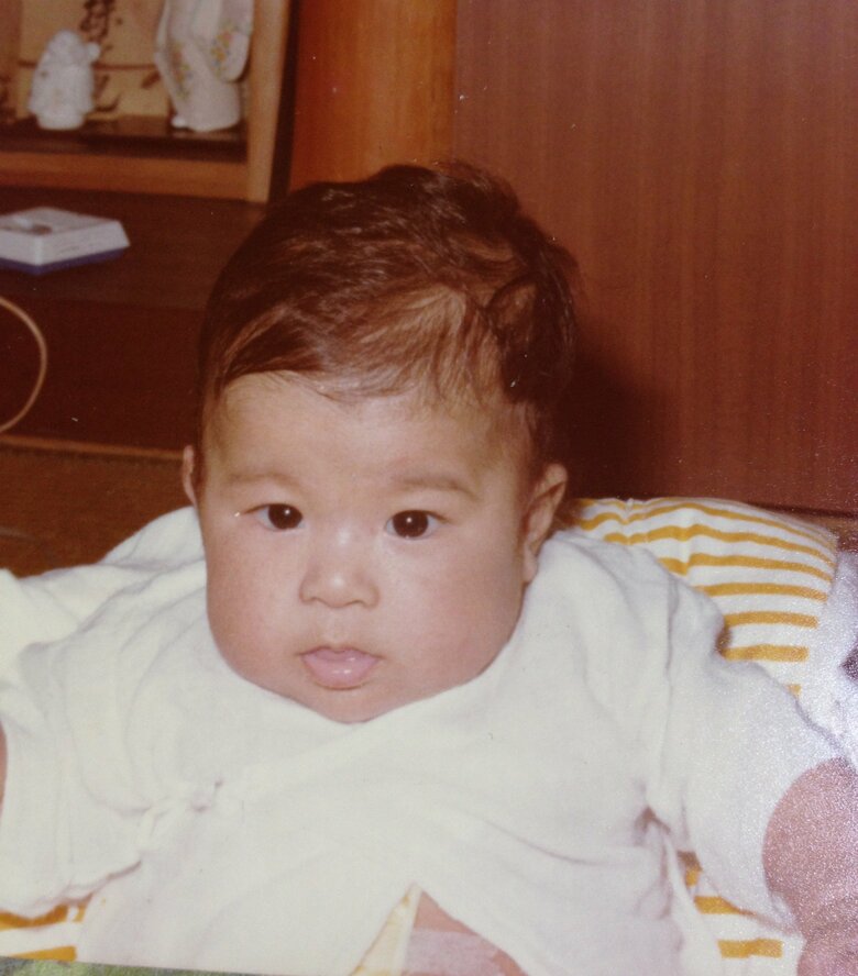 0歳の手術直後。お腹のテープが痛々しい