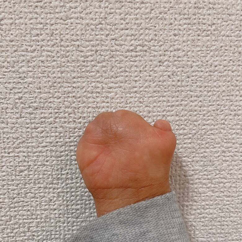 むろいさんの右手