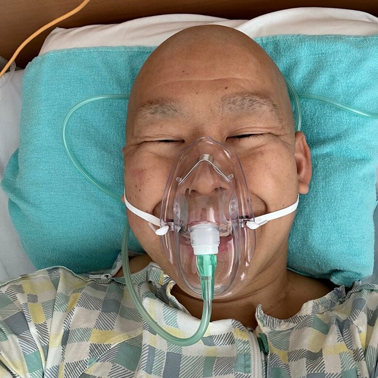 抗がん剤治療の影響で眉毛もまばらに