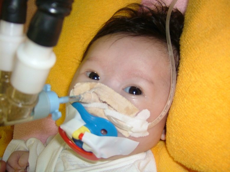 これまで何度も手術を経験してきた菜桜さん