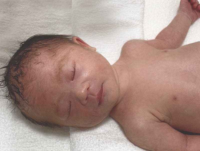 ダウン症を持つ愛子ちゃん