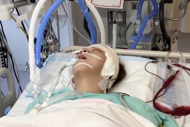 術後、集中治療室での様子