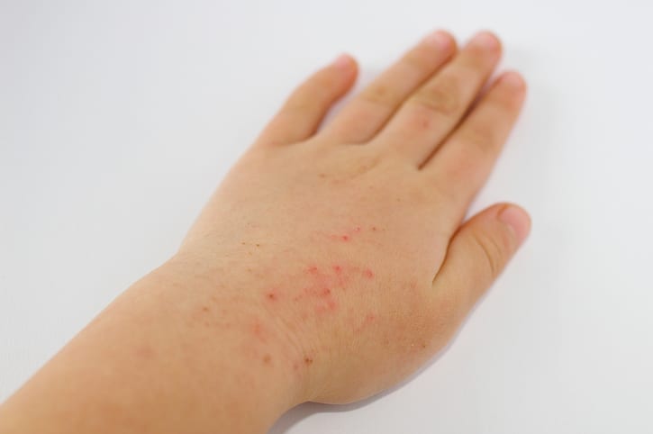 iStock.com/AkikoAoki