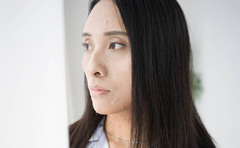 「おまえを殺す」大きな枝で追われた日。難病で「バイオ」と呼ばれた女性がいじめを耐え抜いた「小6の夢」