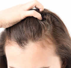 お金を出すから対策しても… 悩む妻の薄毛問題に触れるべきか苦悩する夫の戸惑い