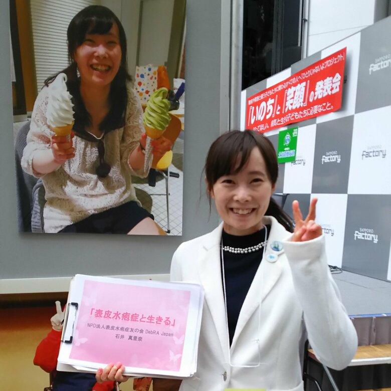 表皮水疱症について講演会やSNSで発信をする梅津真里奈さん