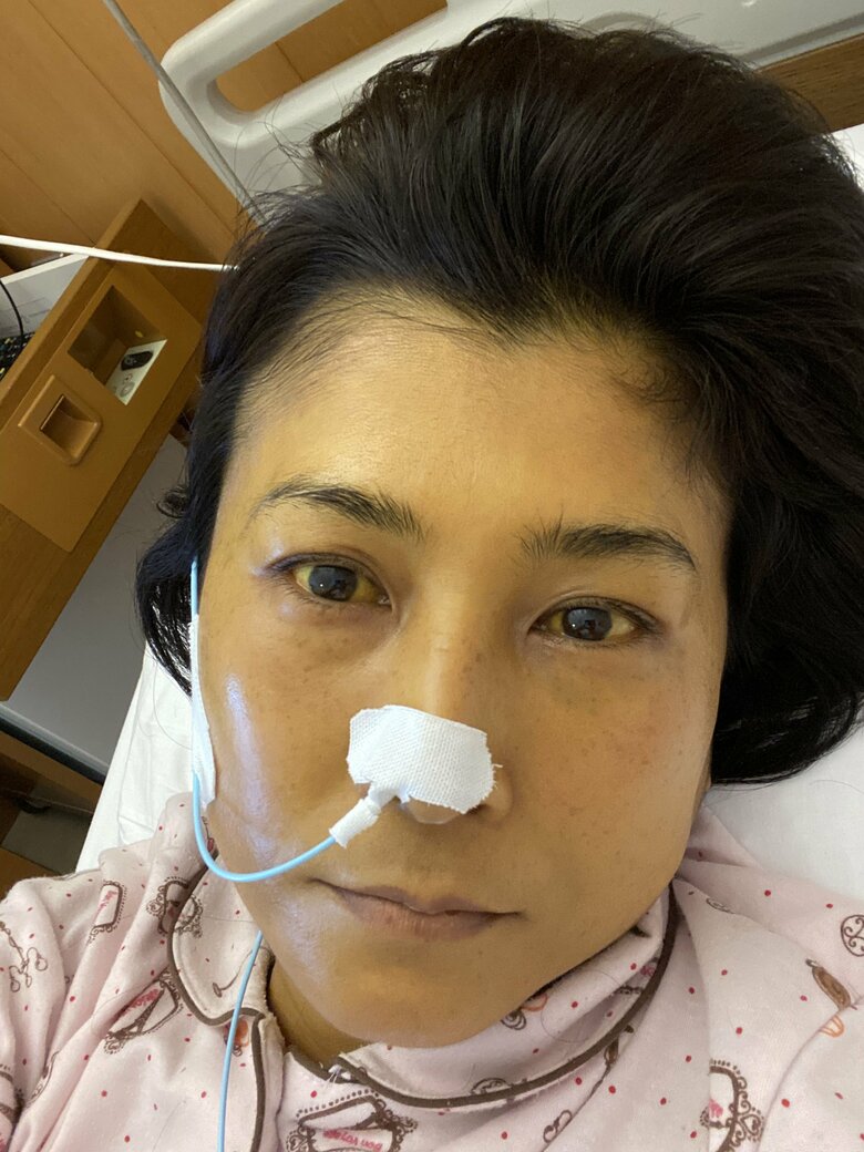 前座時代に肝臓の数値が徐々に悪化していった